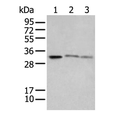 SPIC Antibody from Signalway Antibody (43559) - Antibodies.com