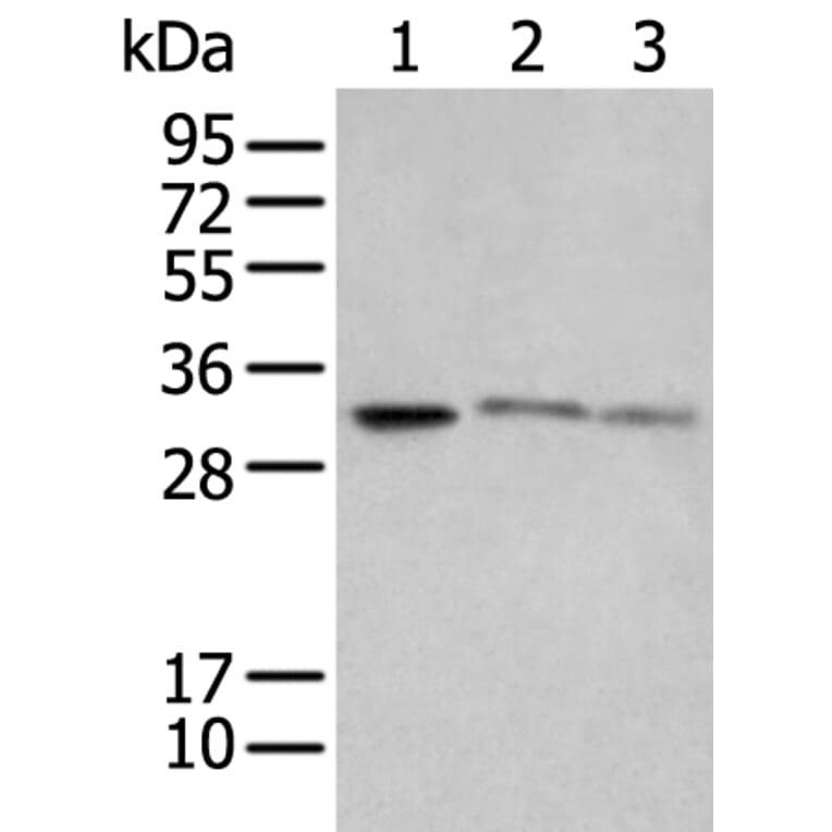 SPIC Antibody from Signalway Antibody (43559) - Antibodies.com