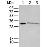 SPIC Antibody from Signalway Antibody (43559) - Antibodies.com