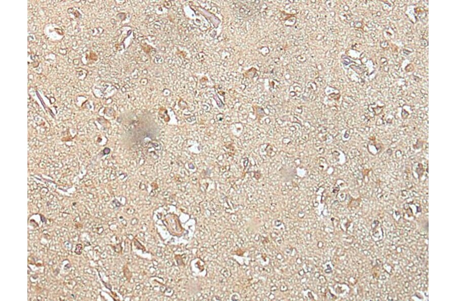 SPIC Antibody from Signalway Antibody (43559) - Antibodies.com