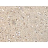 SPIC Antibody from Signalway Antibody (43559) - Antibodies.com