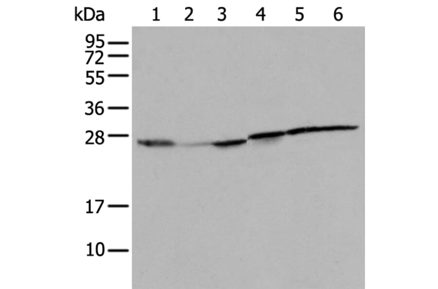 RPL8 Antibody from Signalway Antibody (43561) - Antibodies.com