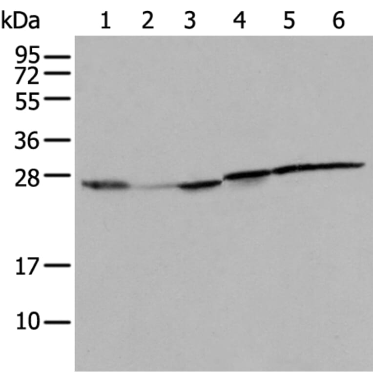 RPL8 Antibody from Signalway Antibody (43561) - Antibodies.com