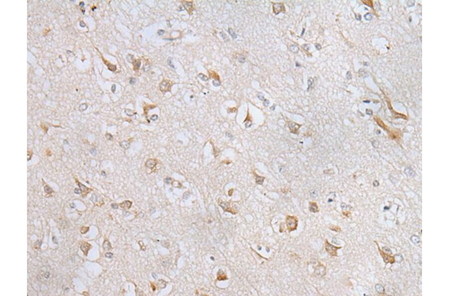 RPL8 Antibody from Signalway Antibody (43561) - Antibodies.com