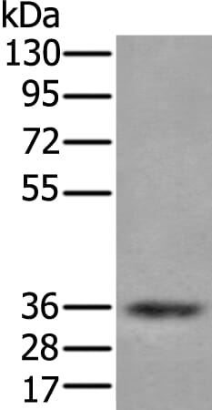 Gel: 8% SDS-PAGE Lysate: 40 &#956;g, Lane: Human testis tissue lysate, Primary antibody: ZPBP antibody at dilution 1/200, Secondary antibody: Goat anti rabbit IgG at 1/8000 dilution, Exposure time: 30 seconds