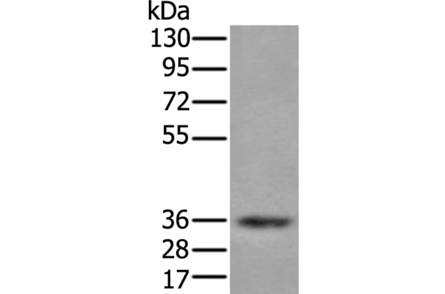 ZPBP Antibody from Signalway Antibody (43583) - Antibodies.com