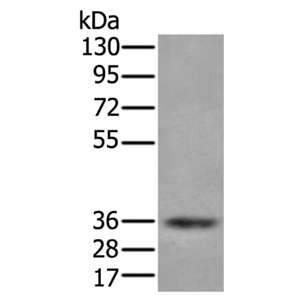 ZPBP Antibody from Signalway Antibody (43583) - Antibodies.com