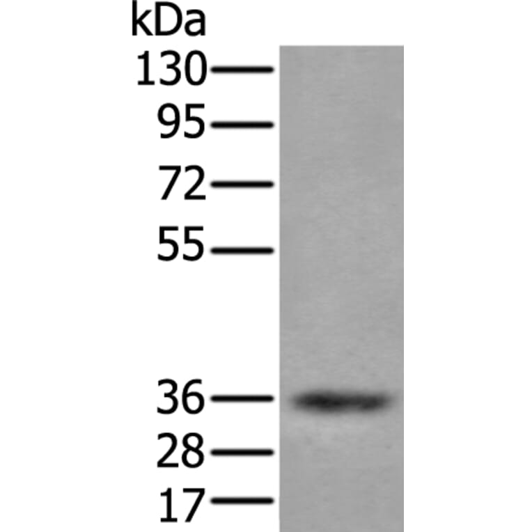 ZPBP Antibody from Signalway Antibody (43583) - Antibodies.com