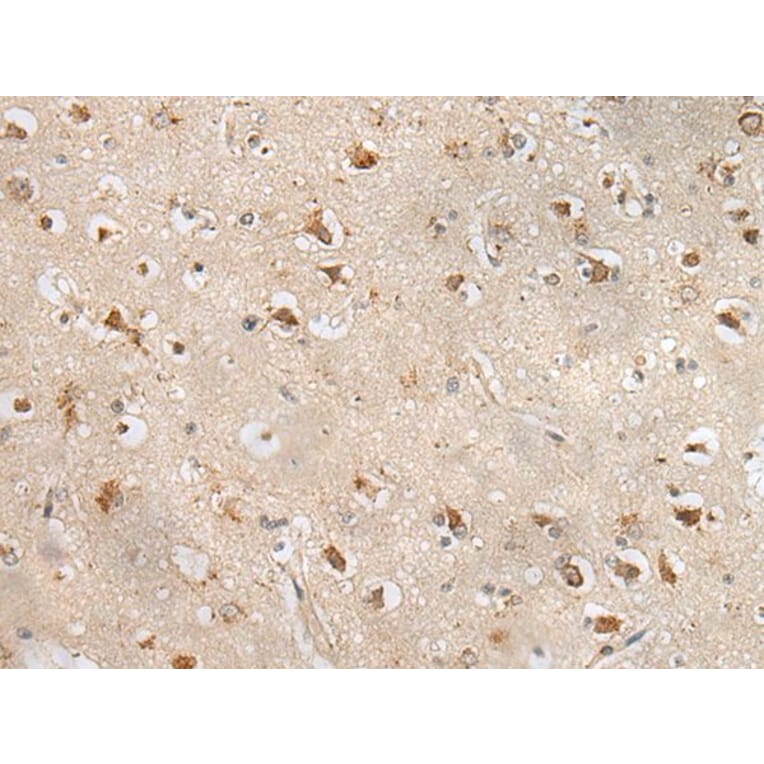 ZPBP Antibody from Signalway Antibody (43583) - Antibodies.com