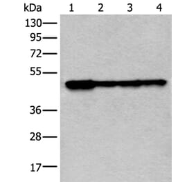 VRK1 Antibody from Signalway Antibody (43595) - Antibodies.com