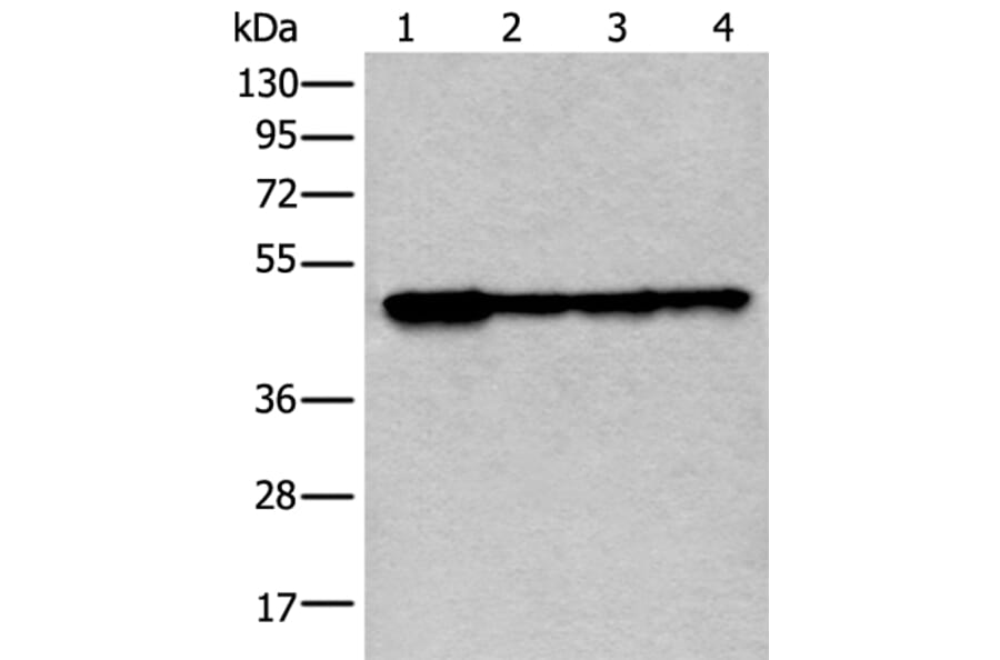 VRK1 Antibody from Signalway Antibody (43595) - Antibodies.com