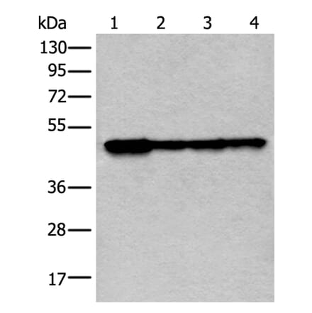 VRK1 Antibody from Signalway Antibody (43595) - Antibodies.com