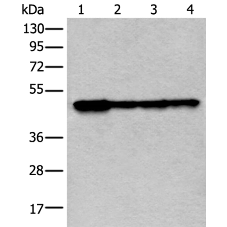 VRK1 Antibody from Signalway Antibody (43595) - Antibodies.com