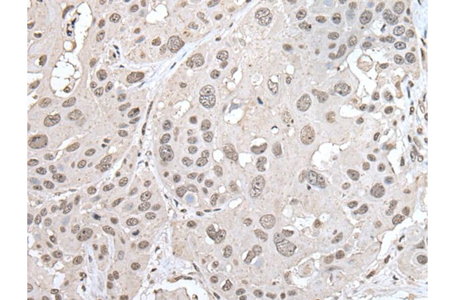 VRK1 Antibody from Signalway Antibody (43595) - Antibodies.com