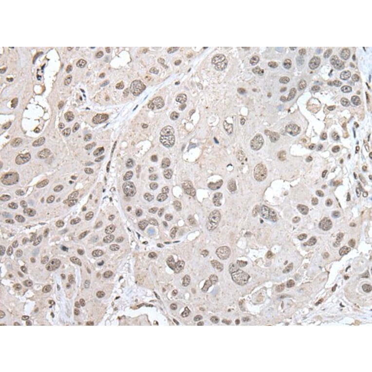 VRK1 Antibody from Signalway Antibody (43595) - Antibodies.com