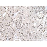 VRK1 Antibody from Signalway Antibody (43595) - Antibodies.com