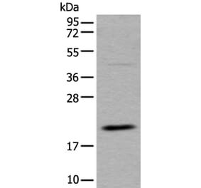 UFC1 Antibody from Signalway Antibody (43612) - Antibodies.com