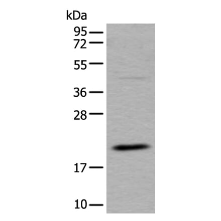 UFC1 Antibody from Signalway Antibody (43612) - Antibodies.com