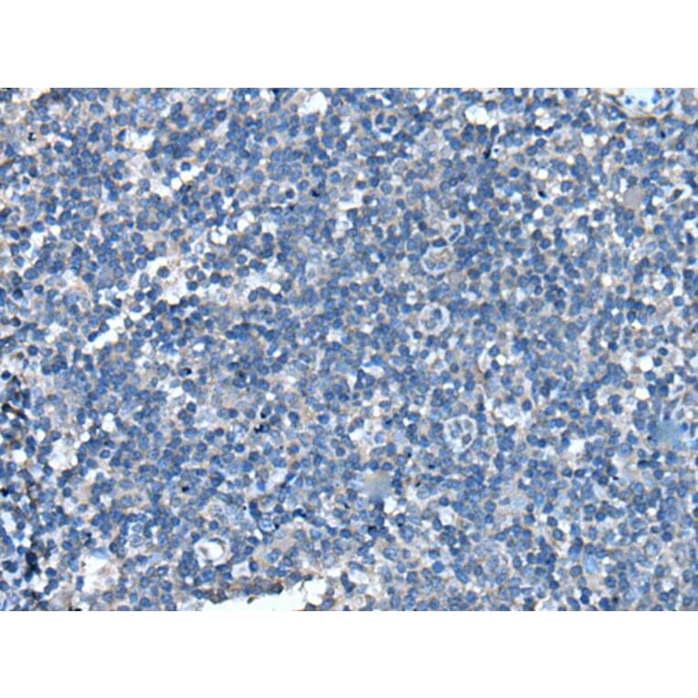 UFC1 Antibody from Signalway Antibody (43612) - Antibodies.com