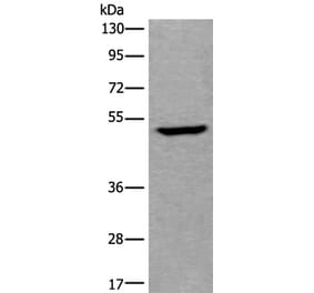 UMPS Antibody from Signalway Antibody (43615) - Antibodies.com
