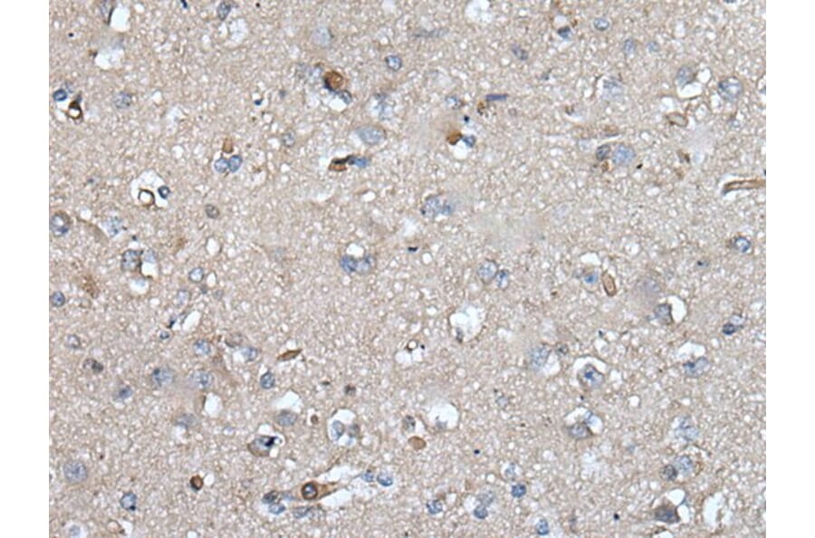 UMPS Antibody from Signalway Antibody (43615) - Antibodies.com