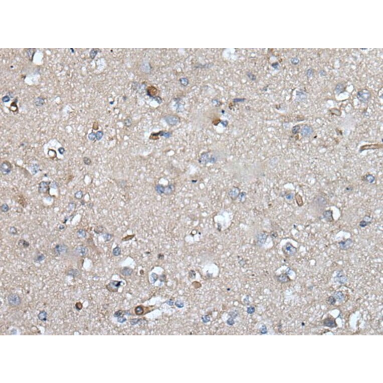 UMPS Antibody from Signalway Antibody (43615) - Antibodies.com