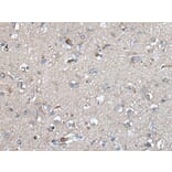 UMPS Antibody from Signalway Antibody (43615) - Antibodies.com