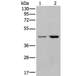 TBX1 Antibody from Signalway Antibody (43639) - Antibodies.com