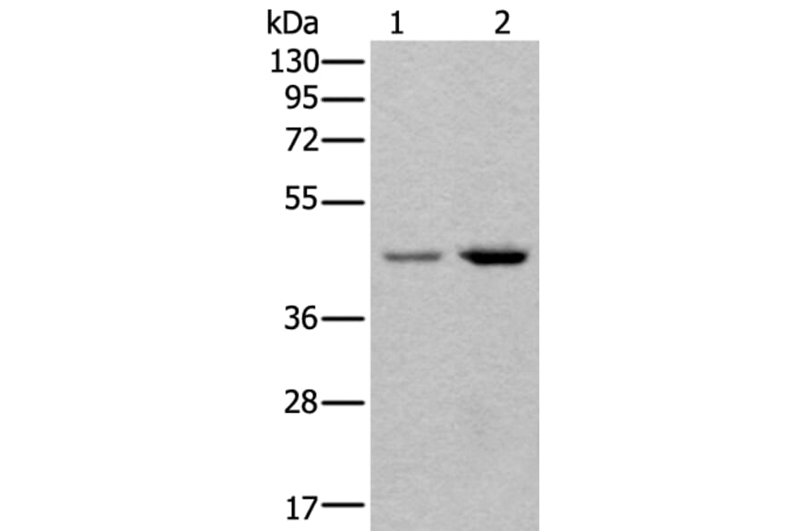 TBX1 Antibody from Signalway Antibody (43639) - Antibodies.com
