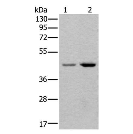 TBX1 Antibody from Signalway Antibody (43639) - Antibodies.com