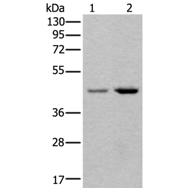 TBX1 Antibody from Signalway Antibody (43639) - Antibodies.com