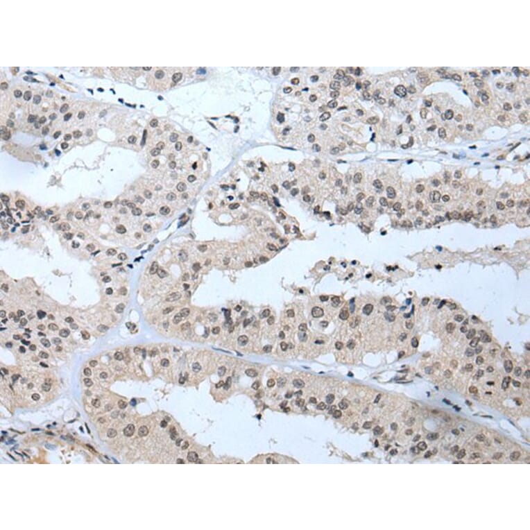 TBX1 Antibody from Signalway Antibody (43639) - Antibodies.com