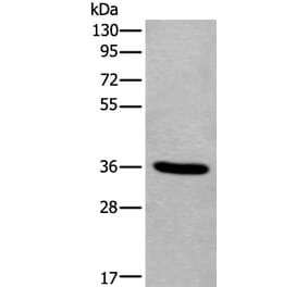 TNMD Antibody from Signalway Antibody (43641) - Antibodies.com
