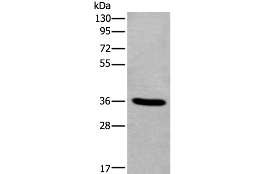 TNMD Antibody from Signalway Antibody (43641) - Antibodies.com