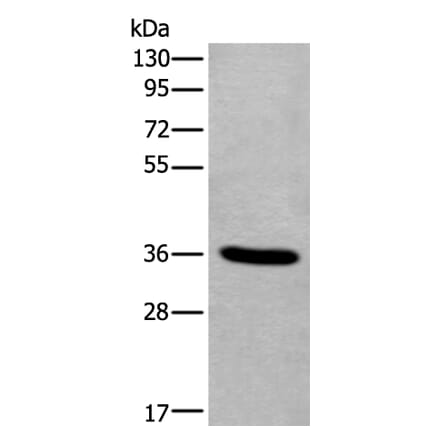 TNMD Antibody from Signalway Antibody (43641) - Antibodies.com