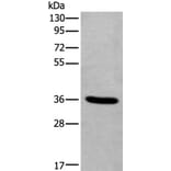TNMD Antibody from Signalway Antibody (43641) - Antibodies.com