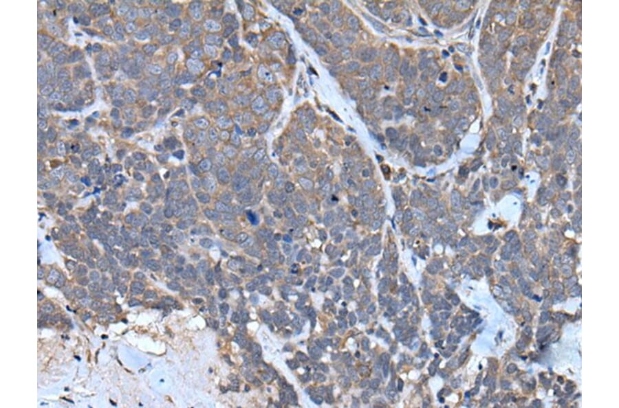 TNMD Antibody from Signalway Antibody (43641) - Antibodies.com