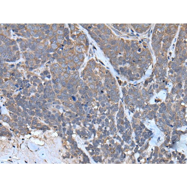 TNMD Antibody from Signalway Antibody (43641) - Antibodies.com