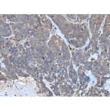 TNMD Antibody from Signalway Antibody (43641) - Antibodies.com