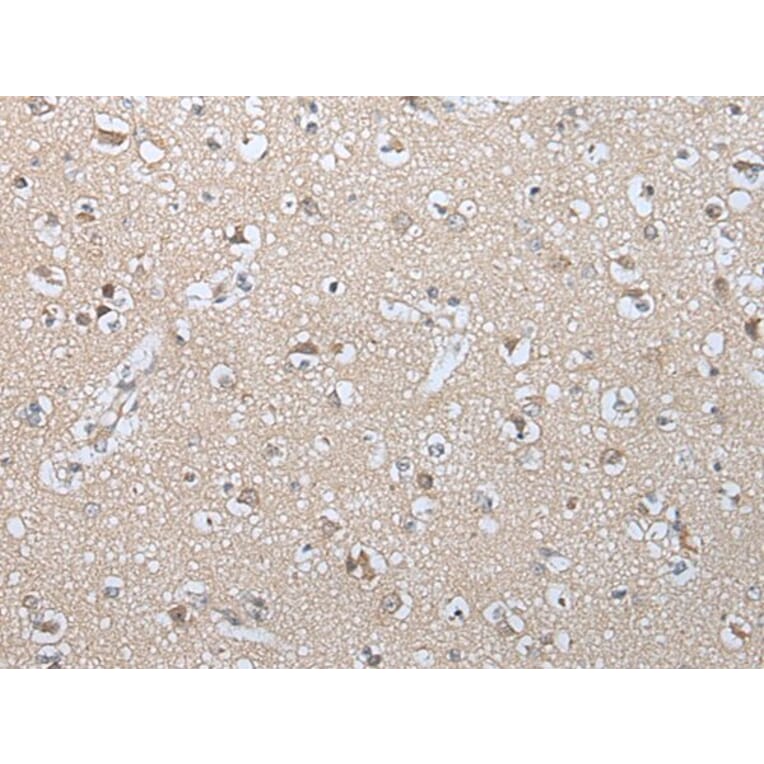 GZMM Antibody from Signalway Antibody (43677) - Antibodies.com