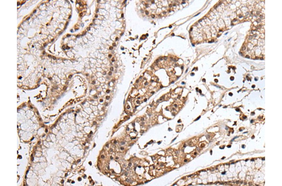 TAF1 Antibody from Signalway Antibody (43706) - Antibodies.com