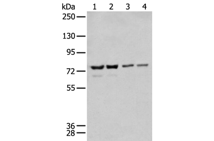 MEN1 Antibody from Signalway Antibody (43716) - Antibodies.com
