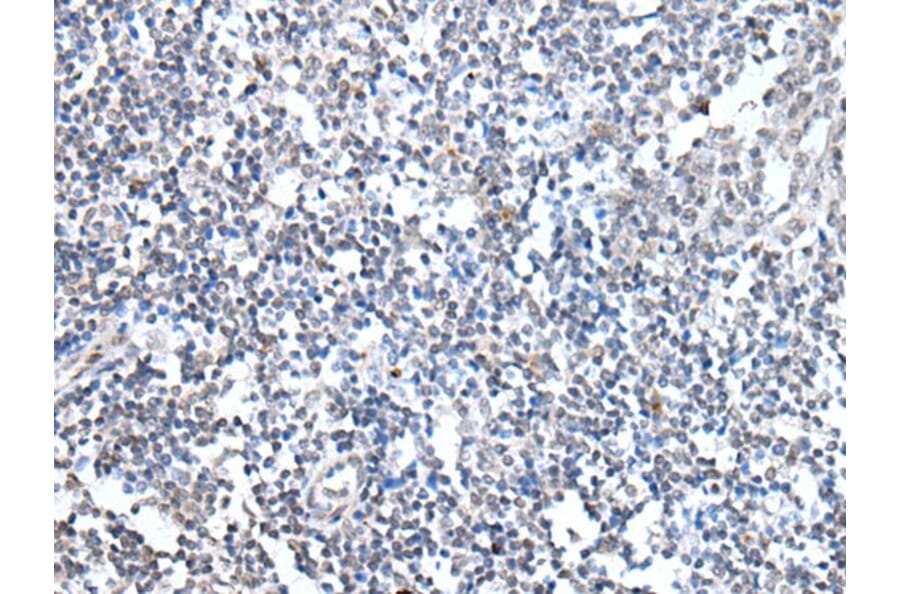 MEN1 Antibody from Signalway Antibody (43716) - Antibodies.com