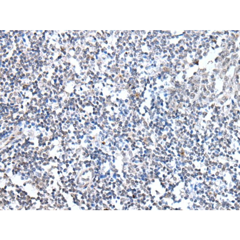 MEN1 Antibody from Signalway Antibody (43716) - Antibodies.com