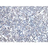 MEN1 Antibody from Signalway Antibody (43716) - Antibodies.com