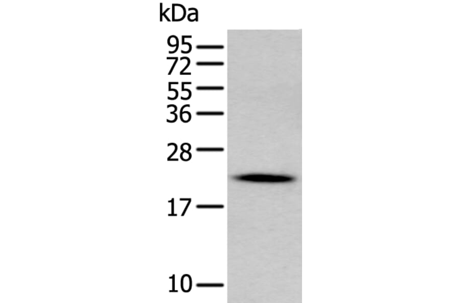 GKN2 Antibody from Signalway Antibody (43724) - Antibodies.com