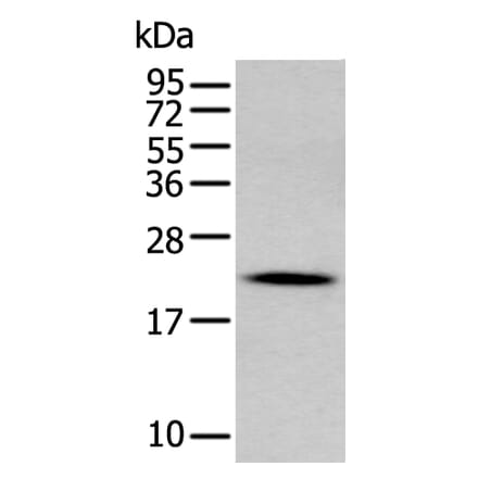 GKN2 Antibody from Signalway Antibody (43724) - Antibodies.com