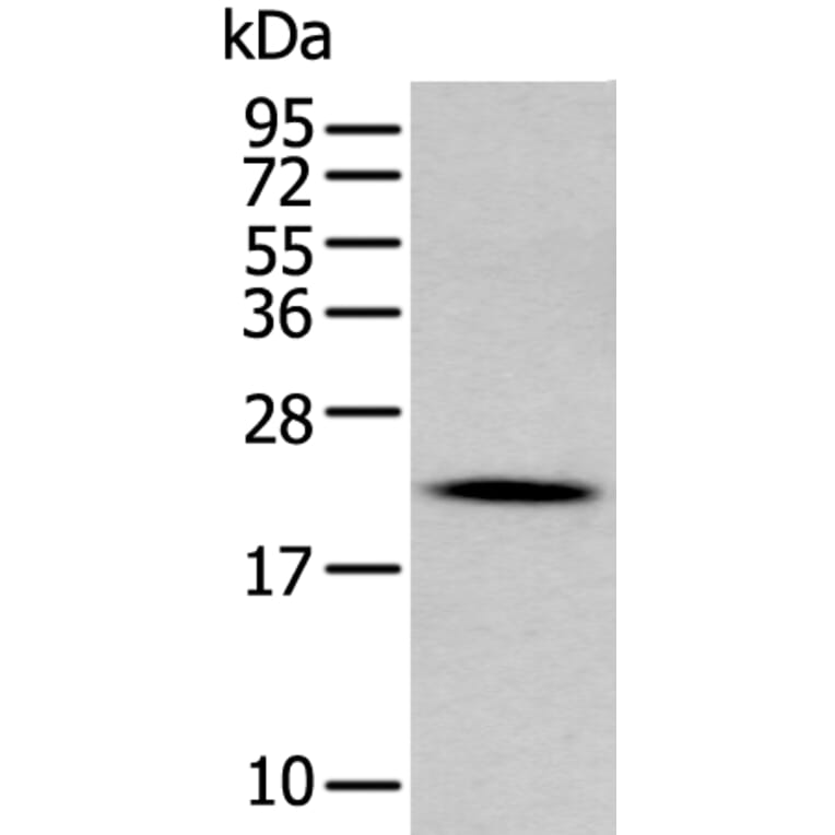 GKN2 Antibody from Signalway Antibody (43724) - Antibodies.com