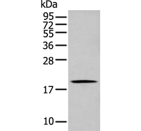 GKN1 Antibody from Signalway Antibody (43725) - Antibodies.com