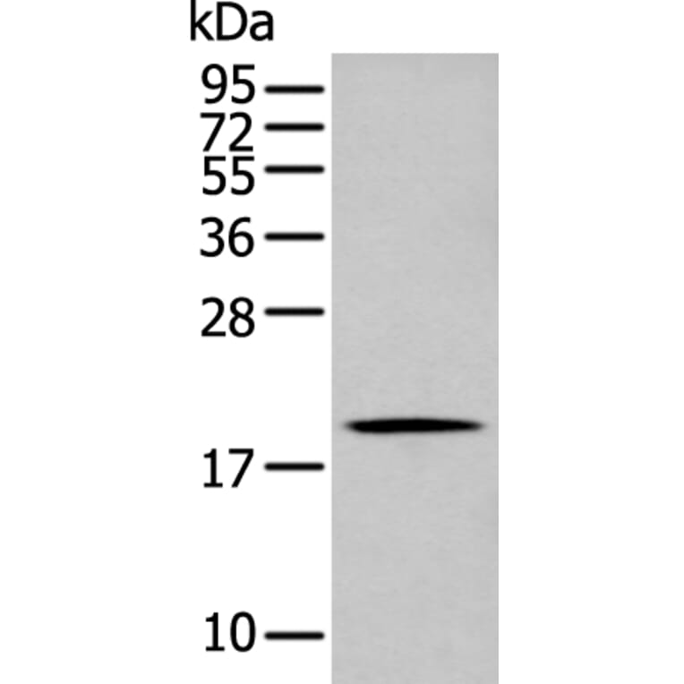 GKN1 Antibody from Signalway Antibody (43725) - Antibodies.com